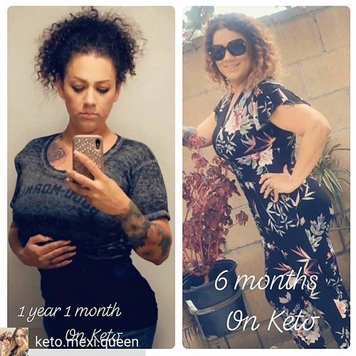 Reposted from @keto.mexi.queen - Wow! I really see a lot of difference on my transformation even though I got a tummy tuck I was still over weight at 215lbs! And lost 70 lbs on keto so far! I am so very proud of myself! Last week I had a doctors appointme