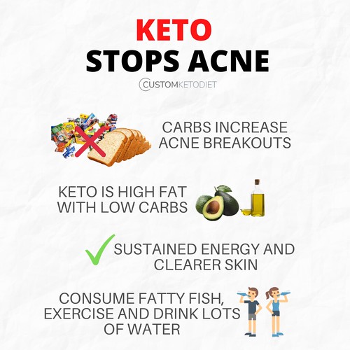 Keto Stops Acne