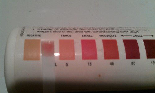 Ketone Strip ...